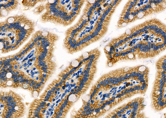 RPS4Y1/RPS4Y2 Antibody in Immunohistochemistry (Paraffin) (IHC (P))