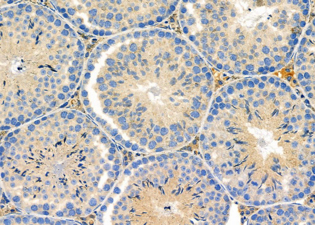 RPS4Y1/RPS4Y2 Antibody in Immunohistochemistry (Paraffin) (IHC (P))