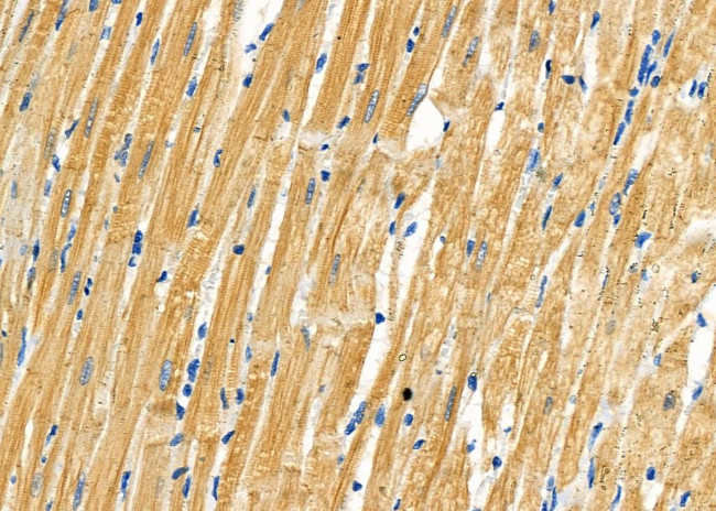 RPS4Y1/RPS4Y2 Antibody in Immunohistochemistry (Paraffin) (IHC (P))