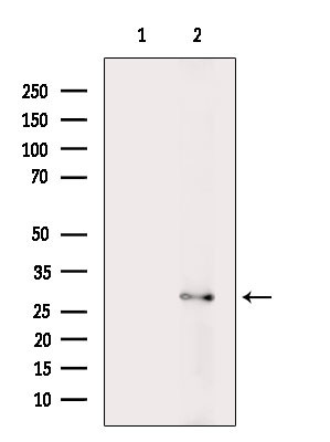 RPS4Y1/RPS4Y2 Antibody in Western Blot (WB)