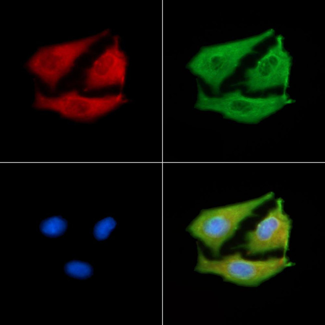 ACAD9 Antibody in Immunocytochemistry (ICC/IF)