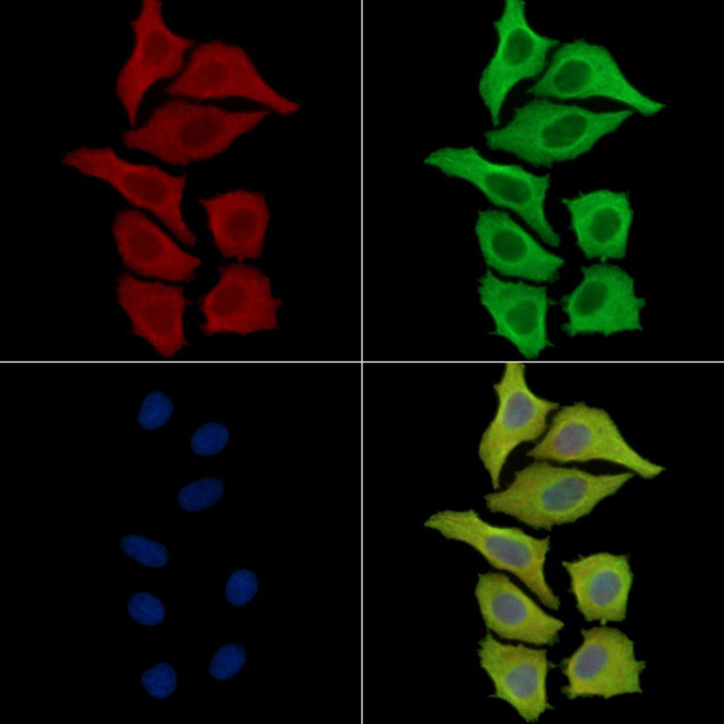 ACOT9 Antibody in Immunocytochemistry (ICC/IF)