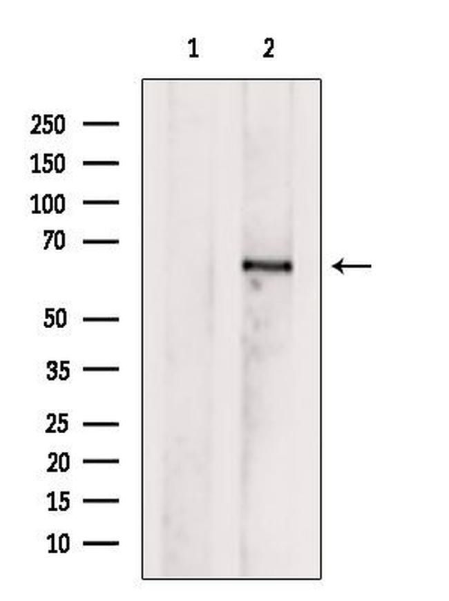 AGXT2 Antibody in Western Blot (WB)
