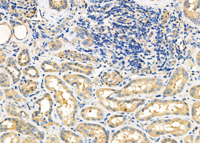 ATP Synthase O Antibody in Immunohistochemistry (Paraffin) (IHC (P))