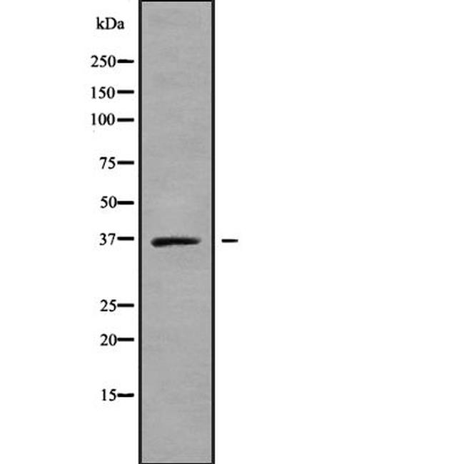 SLC25A14 Antibody in Western Blot (WB)