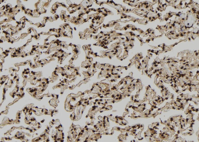 PDE1A Antibody in Immunohistochemistry (Paraffin) (IHC (P))