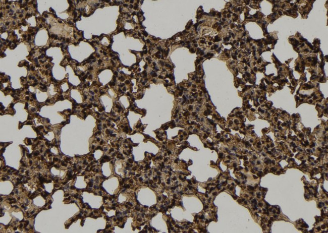 KIF4B Antibody in Immunohistochemistry (Paraffin) (IHC (P))