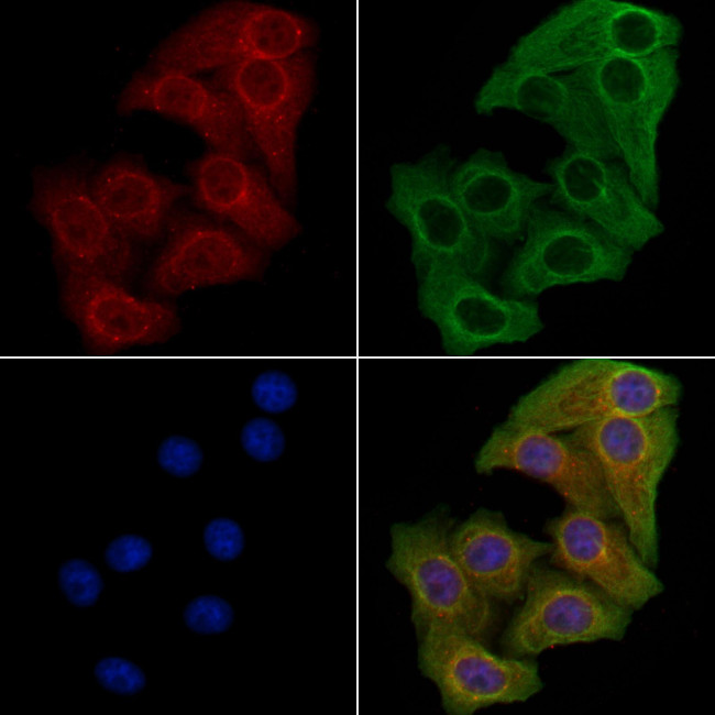 GFM1 Antibody in Immunocytochemistry (ICC/IF)