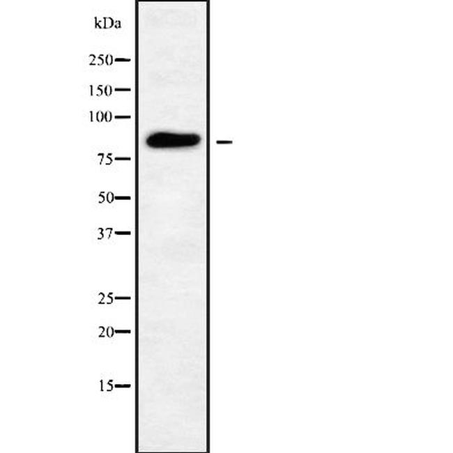 GFM1 Antibody in Western Blot (WB)