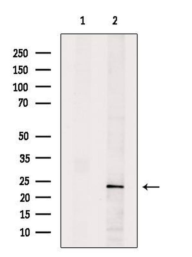 HPGDS Antibody in Western Blot (WB)