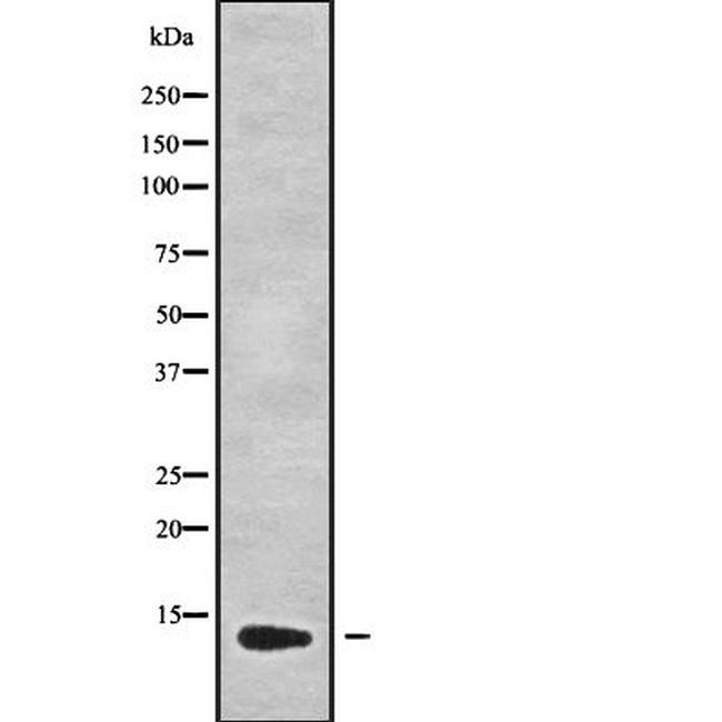 GUCA2B Antibody in Western Blot (WB)