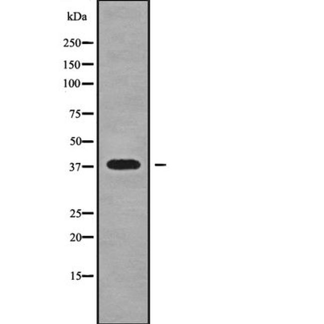 Nkx2.3 Antibody in Western Blot (WB)