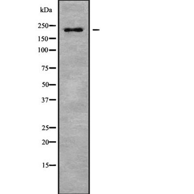 MYH8 Antibody in Western Blot (WB)