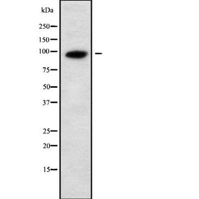 UNC5A Antibody in Western Blot (WB)