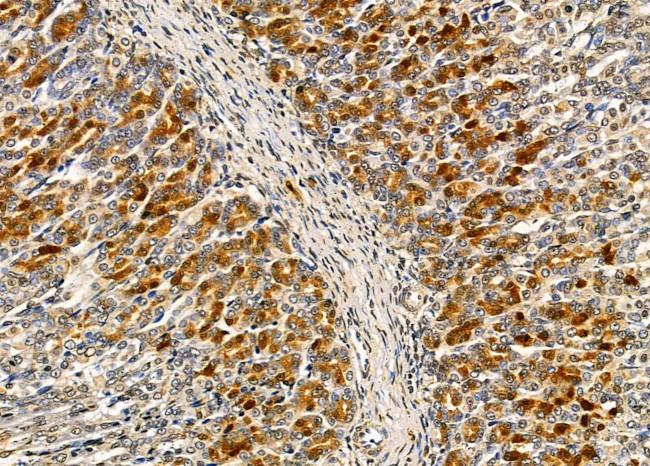 NBPF6 Antibody in Immunohistochemistry (Paraffin) (IHC (P))