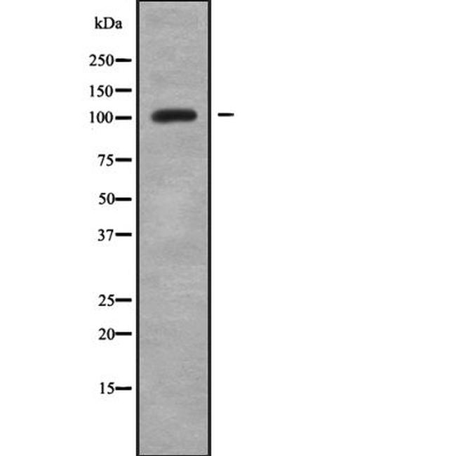 PEX6 Antibody in Western Blot (WB)