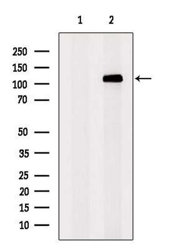 SUGP2 Antibody in Western Blot (WB)