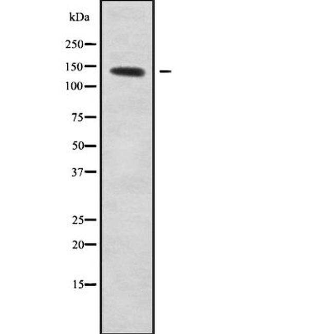 SLC9A10 Antibody in Western Blot (WB)