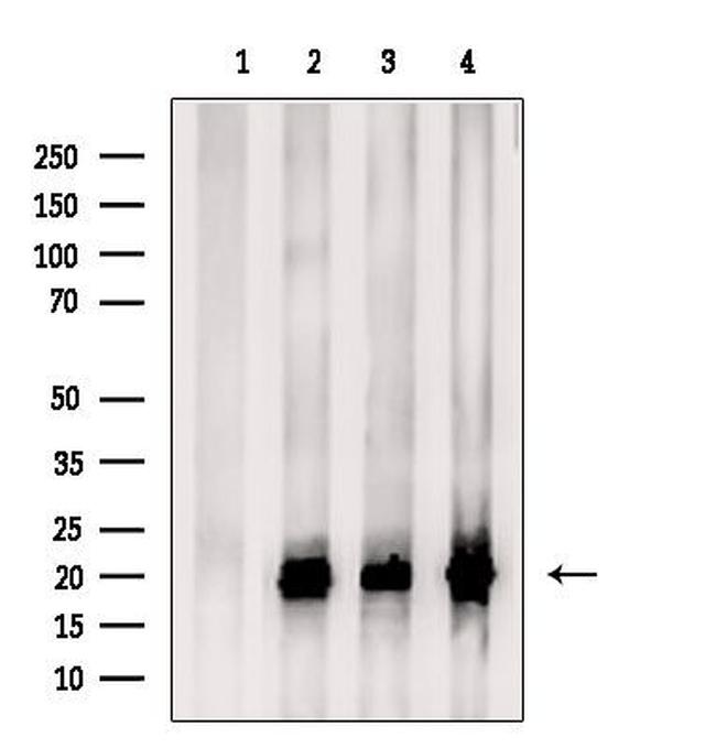 TCEAL2 Antibody in Western Blot (WB)