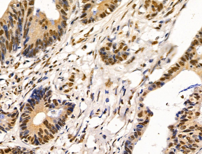 HDAC7 Antibody in Immunohistochemistry (Paraffin) (IHC (P))