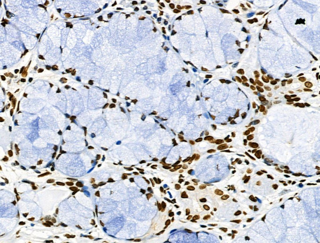 Phospho-CD227 (Mucin 1) (Tyr1229) Antibody in Immunohistochemistry (Paraffin) (IHC (P))