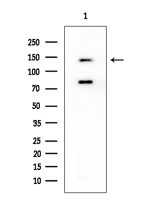 HGK Antibody in Western Blot (WB)