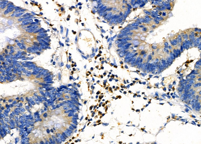 HOXC6 Antibody in Immunohistochemistry (Paraffin) (IHC (P))