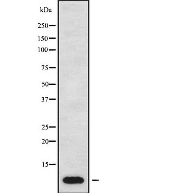 ATP5E Antibody in Western Blot (WB)