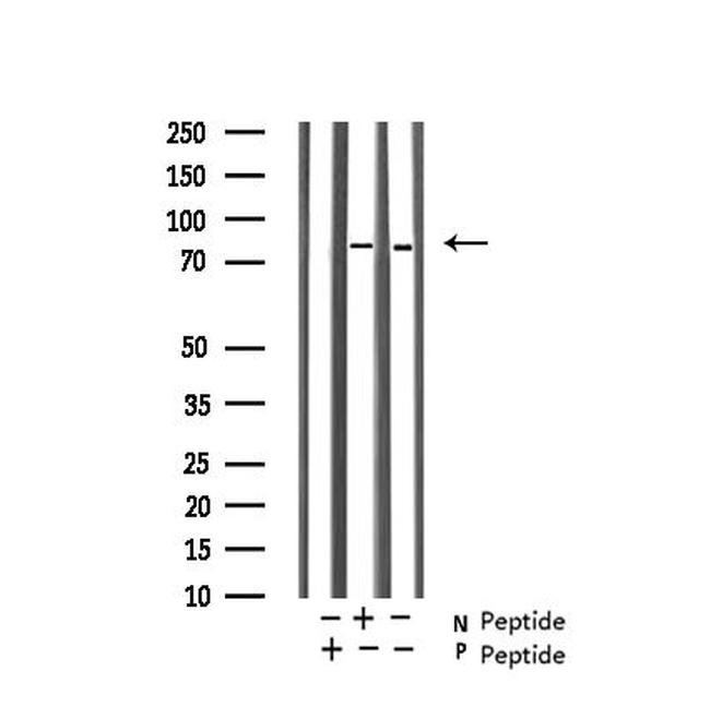 Phospho-Glucocorticoid Receptor (Ser203) Antibody in Western Blot (WB)