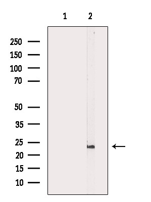 Pan Ras Antibody in Western Blot (WB)