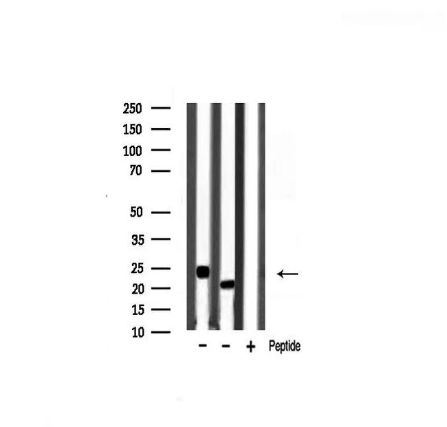 Pan Ras Antibody in Western Blot (WB)