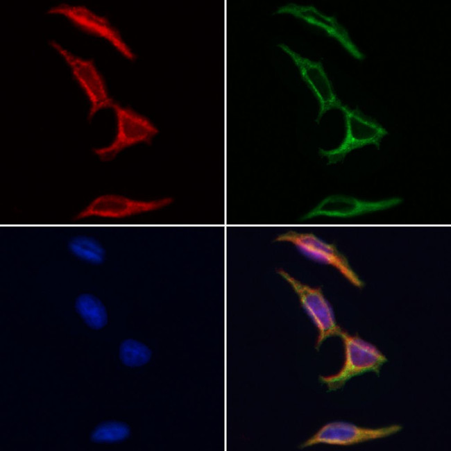 HGS Antibody in Immunocytochemistry (ICC/IF)