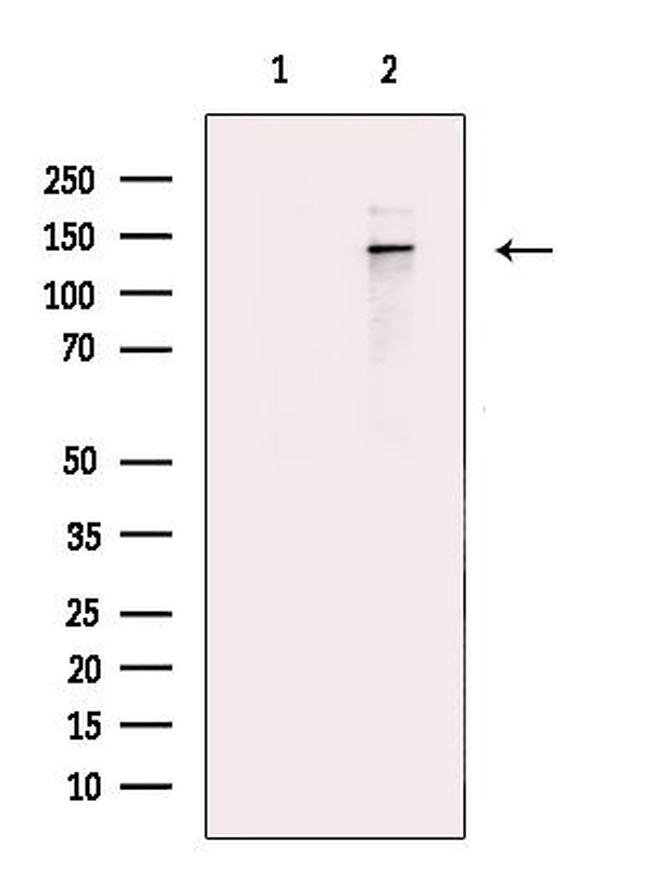 Hairless Antibody in Western Blot (WB)