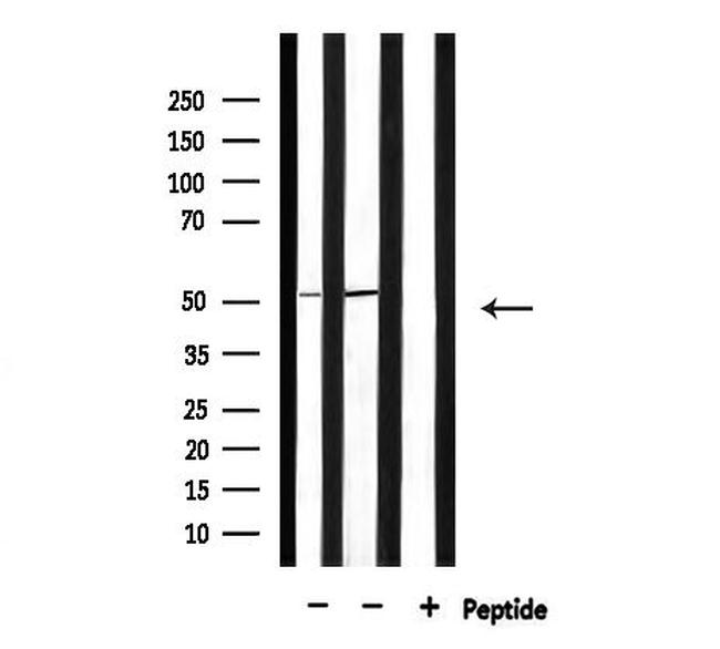 PFKFB1/PFKFB4 Antibody in Western Blot (WB)