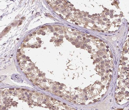 CHOP Antibody in Immunohistochemistry (Paraffin) (IHC (P))