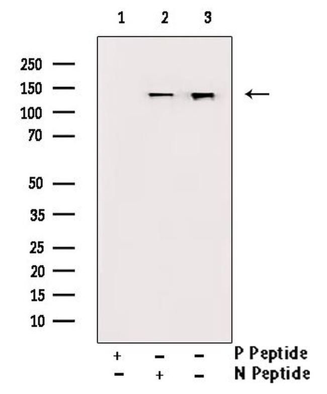 Phospho-JAK1 (Tyr1034) Antibody in Western Blot (WB)