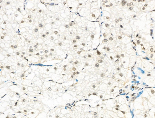 Phospho-CENPA (Ser7) Antibody in Immunohistochemistry (Paraffin) (IHC (P))