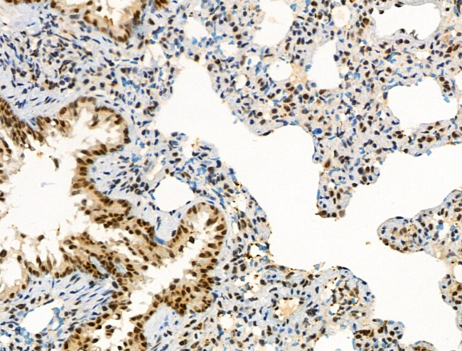 Phospho-CENPA (Ser7) Antibody in Immunohistochemistry (Paraffin) (IHC (P))