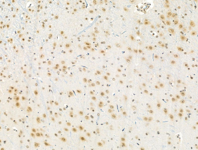 Phospho-CENPA (Ser7) Antibody in Immunohistochemistry (Paraffin) (IHC (P))