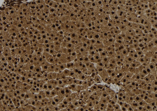 Phospho-CENPA (Ser7) Antibody in Immunohistochemistry (Paraffin) (IHC (P))