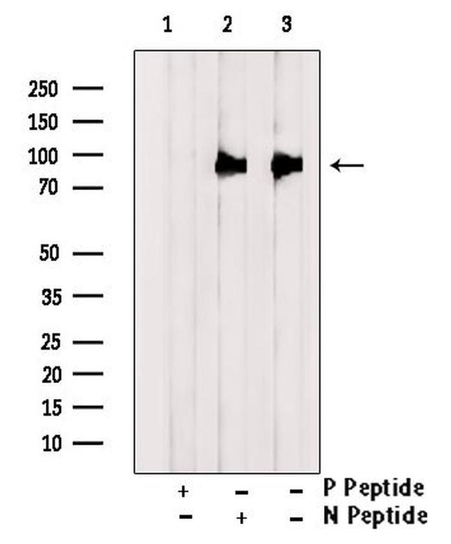 Phospho-DR6 (Ser562) Antibody in Western Blot (WB)