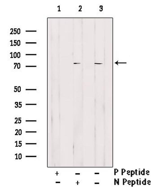 Phospho-GRB10 (Ser476) Antibody in Western Blot (WB)