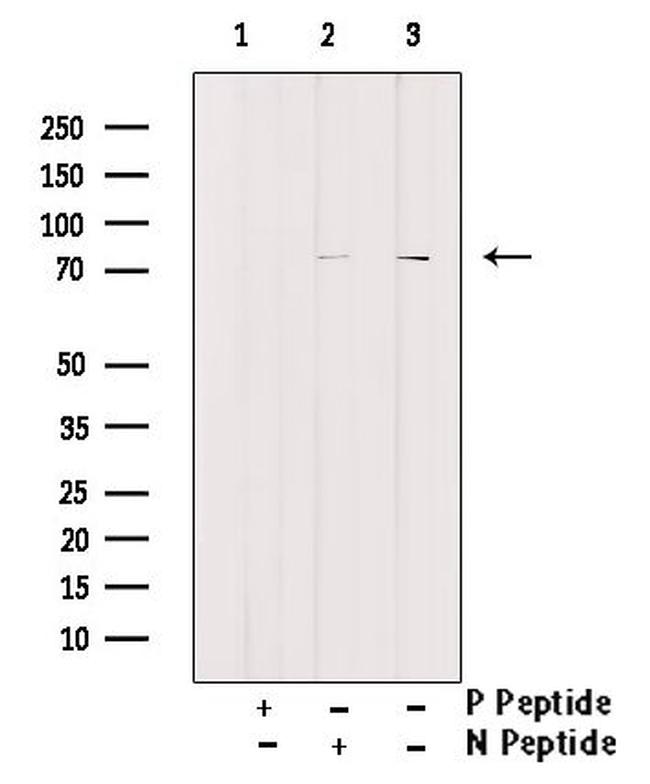 Phospho-HSL (Ser853) Antibody in Western Blot (WB)