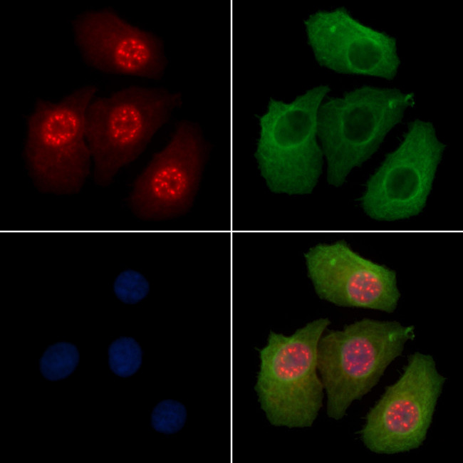 Phospho-NuMA (Thr2055) Antibody in Immunocytochemistry (ICC/IF)