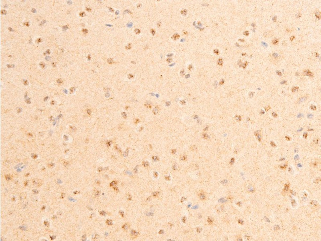 Phospho-PDPK1 (Ser241) Antibody in Immunohistochemistry (Paraffin) (IHC (P))