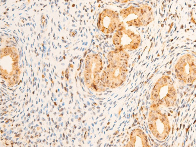 Phospho-PDPK1 (Ser241) Antibody in Immunohistochemistry (Paraffin) (IHC (P))