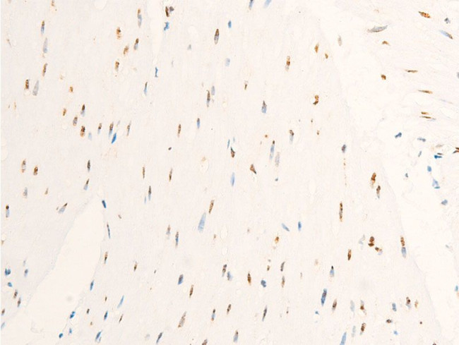 Phospho-c-Myc (Ser62) Antibody in Immunohistochemistry (Paraffin) (IHC (P))