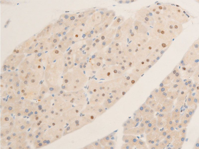 Phospho-c-Myc (Ser62) Antibody in Immunohistochemistry (Paraffin) (IHC (P))