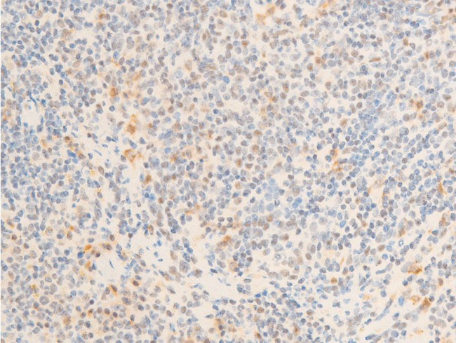 Phospho-c-Myc (Ser62) Antibody in Immunohistochemistry (Paraffin) (IHC (P))