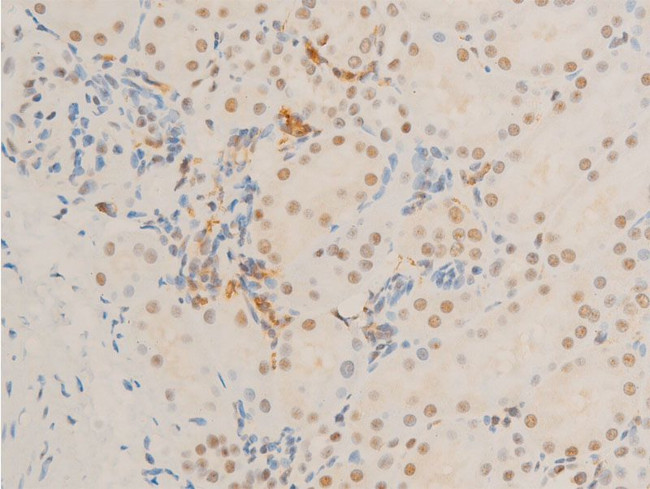 Phospho-c-Myc (Ser62) Antibody in Immunohistochemistry (Paraffin) (IHC (P))